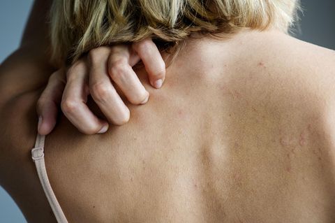 Eine junge Frau kratzt sich am Rücken