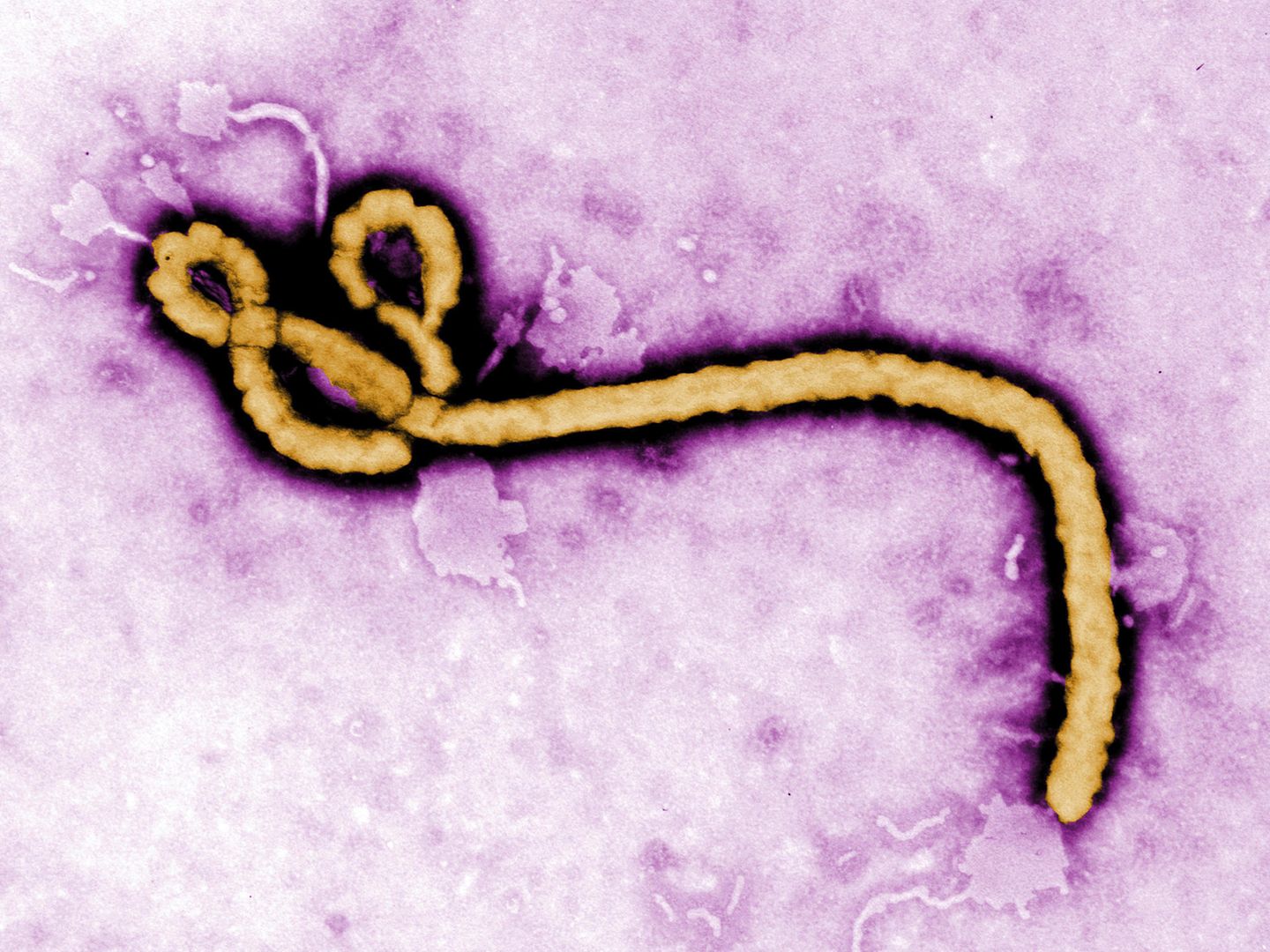 Ebola im Kongo stellt WHO unter Zugzwang