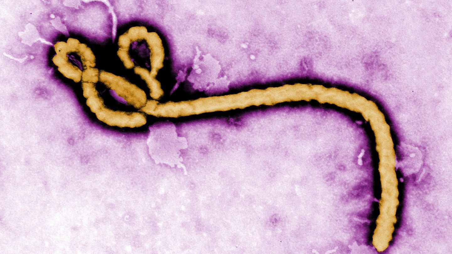 WHO schickt mobiles Ebola-Labor in den Kongo: Eine Aufnahme zeigt ein einzelnes Viruspartikel des Ebola-Virus.
