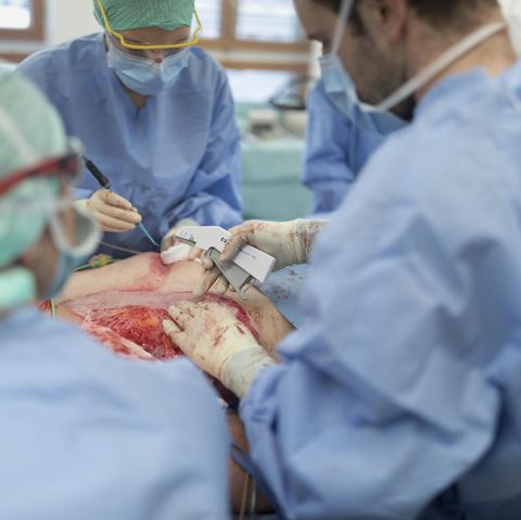 Operation