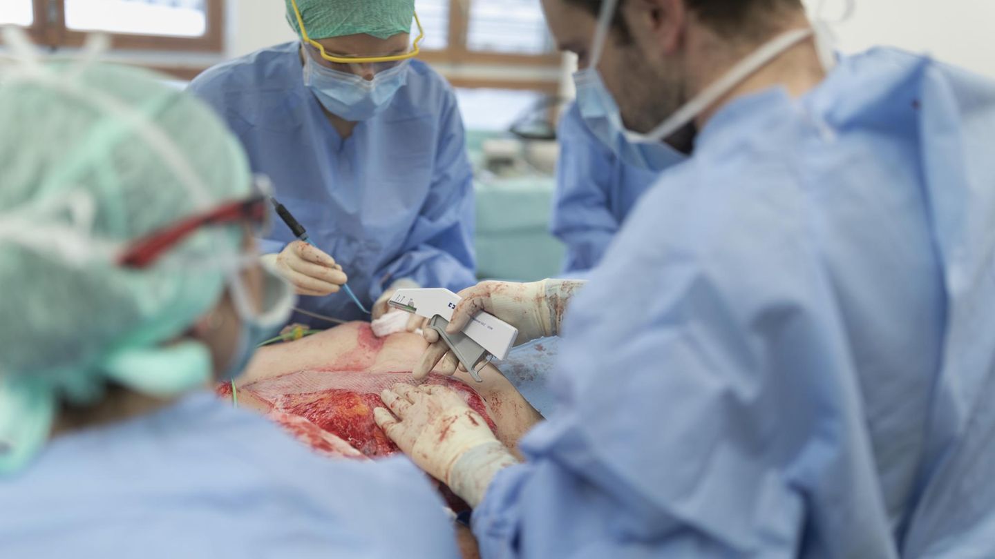 Operation