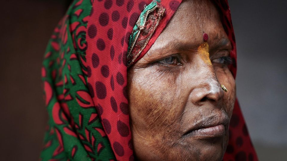 Indien: Für immer gezeichnet: Geeta, über zwei Jahrzehnte nach der schrecklichen Nacht Für immer gezeichnet: Geeta, über zwei Jahrzehnte nach der schrecklichen Nacht