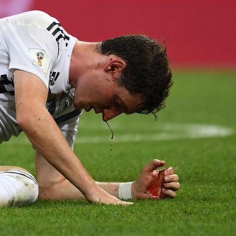 Sebastian Rudy blutet