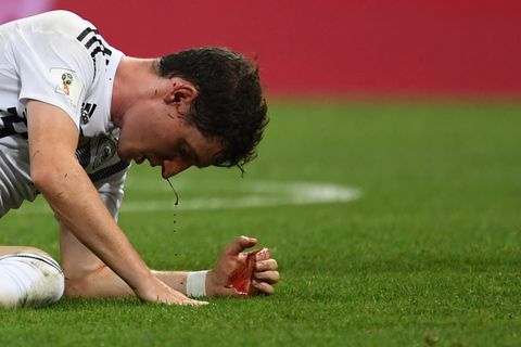 Sebastian Rudy blutet