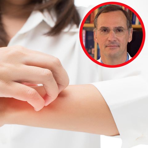 "Kein Patient ist wie der andere": Was hilft (wirklich) gegen Neurodermitis? - Experte klärt auf