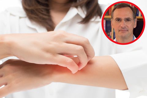 "Kein Patient ist wie der andere": Was hilft (wirklich) gegen Neurodermitis? - Experte klärt auf