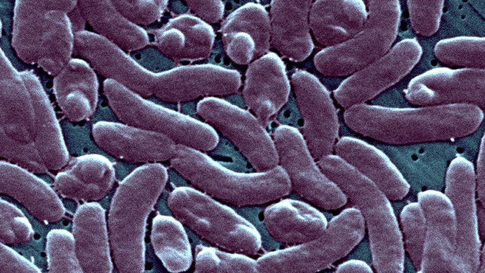 Vermehrt Infektionen mit fleischfressenden Bakterien in Alabama STERN.de