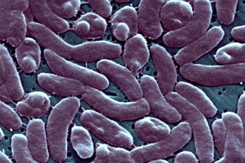 Eine Gruppierung von Vibrio Vulnificus-Bakterien unter dem Mikroskop