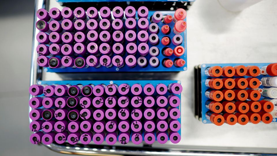 Patientenröhrchen warten während der Durchführung eines HIV-Suchtests auf die Weiterverarbeitung