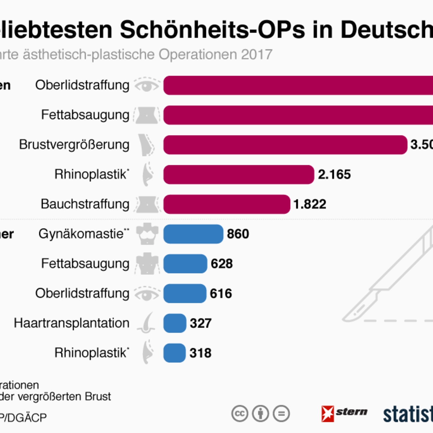 Was gibt es für Schönheits OP?