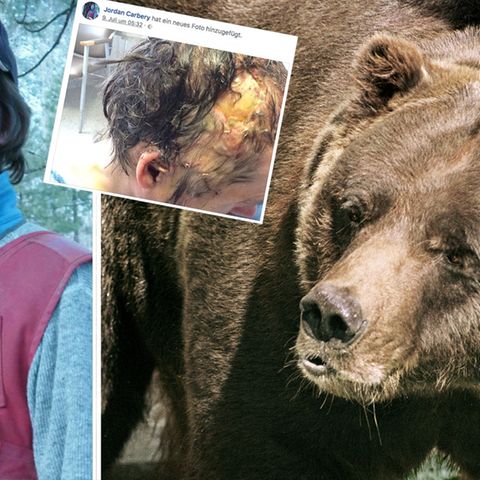 Jordan Carbery, ein Facebook-Foto seiner Kopfwunde und ein Grizzlybär