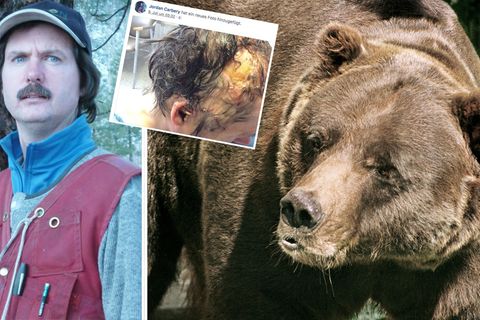 Jordan Carbery, ein Facebook-Foto seiner Kopfwunde und ein Grizzlybär