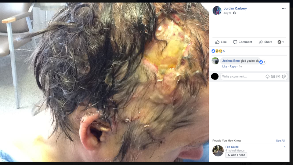 Der Grizzly riss Jordan Carbery einen Teil der Kopfhaut ab - mit den Zähnen Der Grizzly riss Jordan Carbery einen Teil der Kopfhaut ab - mit den Zähnen