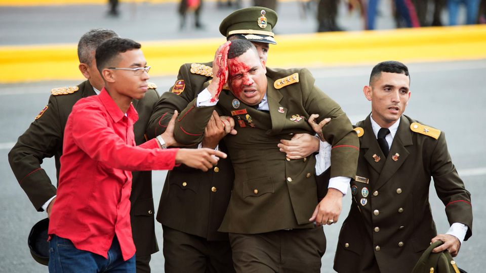 Ein Soldat blutet am Kopf, nachdem es bei einer Militärparade in Venezuela einen versuchten Anschlag gegen Staatschef Nicolas Maduro gegeben hat. Maduro soll unverletzt geblieben sein.