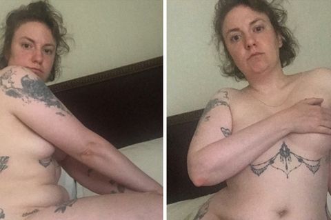Nach Gebärmutter-OP: Lena Dunham postet Nacktbilder – die Botschaft dahinter ist alles andere als oberflächlich
