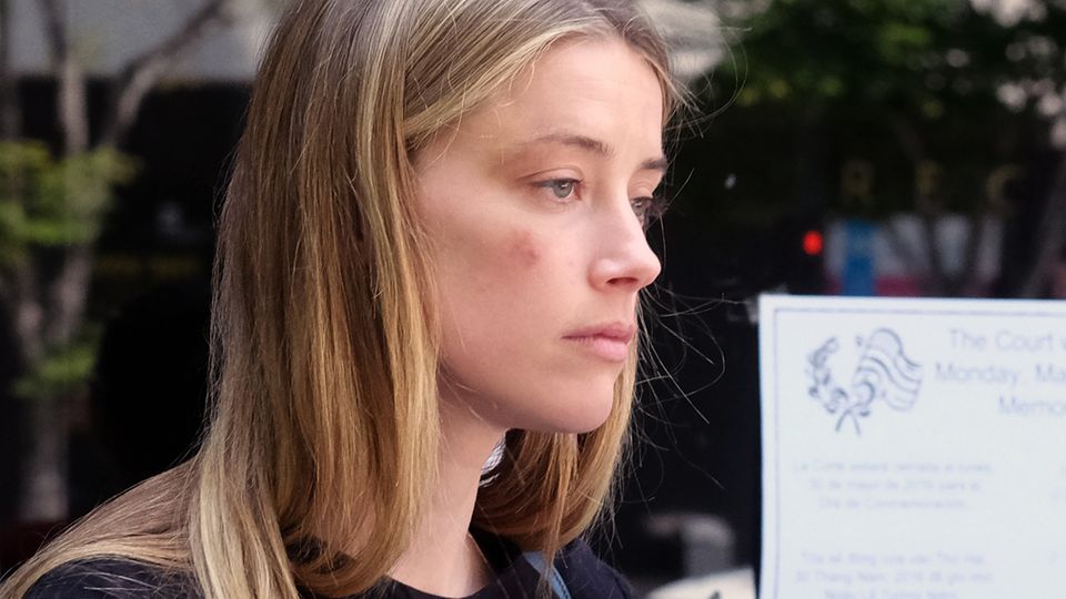 Ex-Frau von Johnny Depp: Amber Heard nach der angeblichen Attacke von Johnny Depp im Mai 2016 Amber Heard nach der angeblichen Attacke von Johnny Depp im Mai 2016