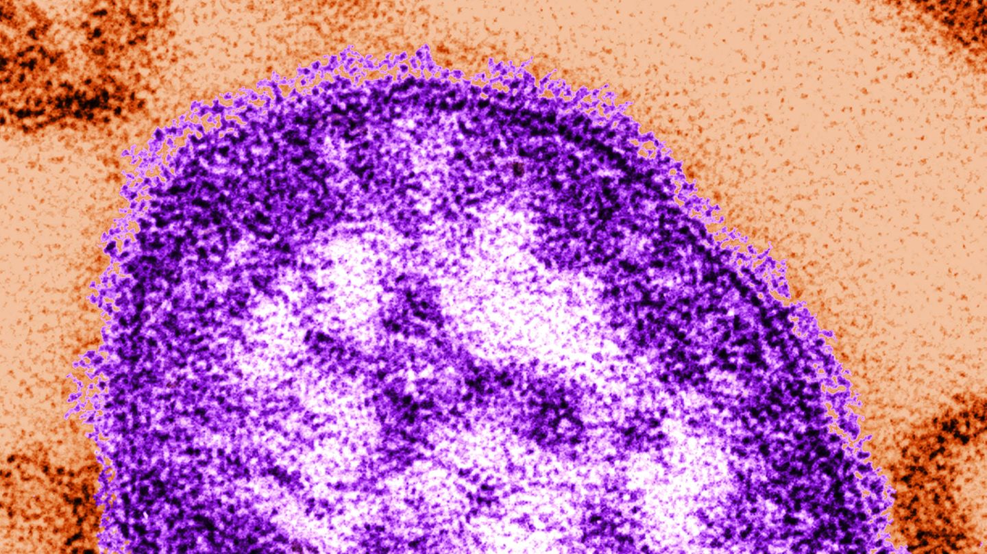 Masernvirus