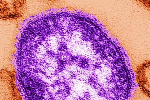 Masernvirus