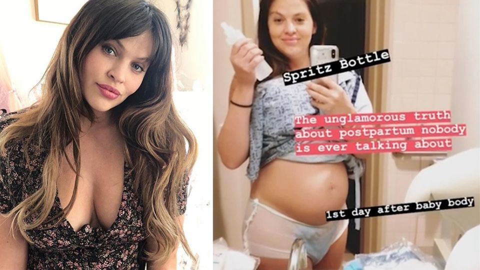 Hana Nitsche: So sieht ein echter After-Baby-Body aus