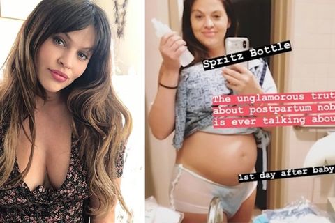 Hana Nitsche: So sieht ein echter After-Baby-Body aus