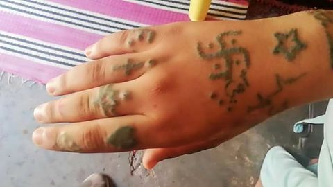 Hakenkreuze und Beleidigungen: In Marokko wurde ein Mädchen mit erniedrigende Tattoos gebrandmarkt 