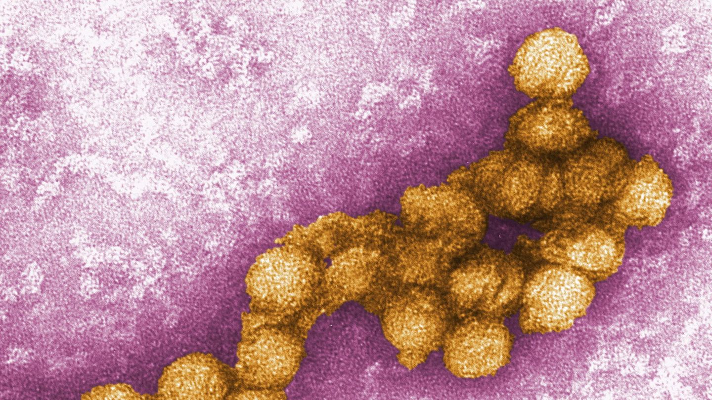 West-Nil-Virus unter einem Elektronenmikroskop