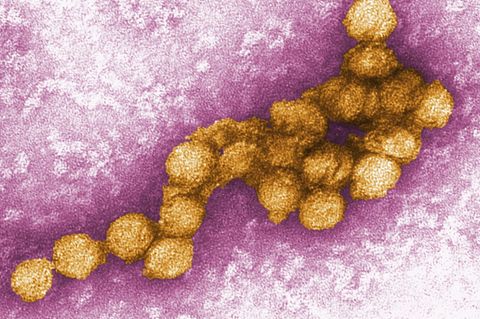 West-Nil-Virus unter einem Elektronenmikroskop
