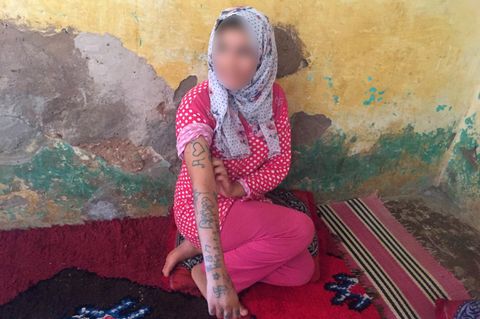 Marokko: Die 17-jährige Khadija wurde gewaltsam am ganzen Körper tätowiert