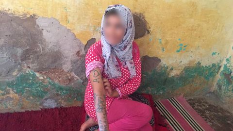 Marokko: Die 17-jährige Khadija wurde gewaltsam am ganzen Körper tätowiert