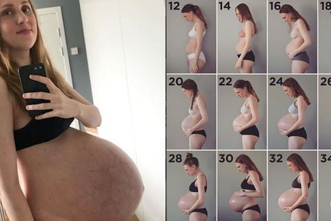 Drillinge: Diese Babykugel wird zum Internethit - mit bezauberndem Happy End