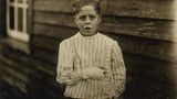 Giles Edmund Newsom war elf Jahre alt, als er in eine Maschine stürzte und zwei Finger verlor.