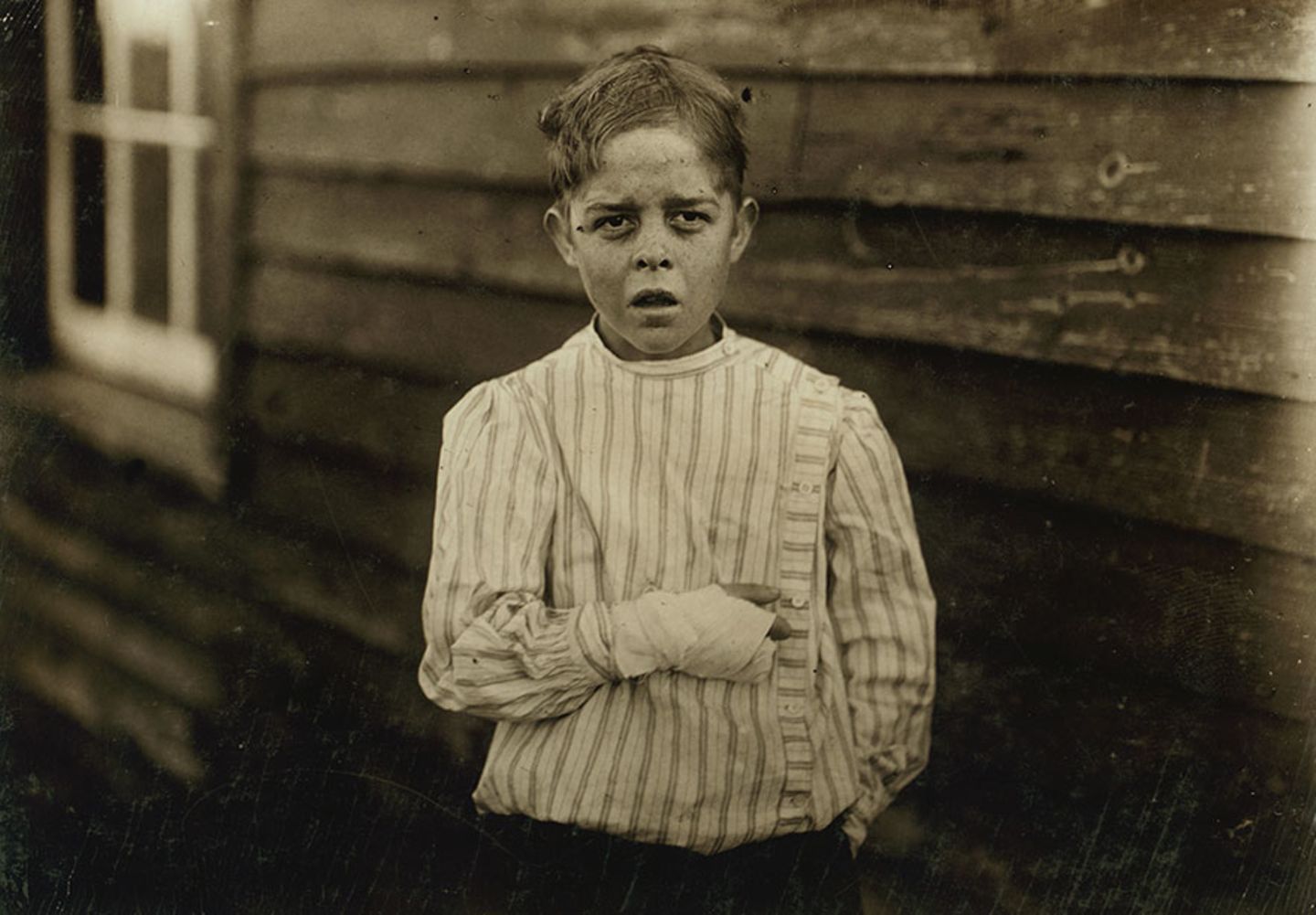 Giles Edmund Newsom war elf Jahre alt, als er in eine Maschine stürzte und zwei Finger verlor.