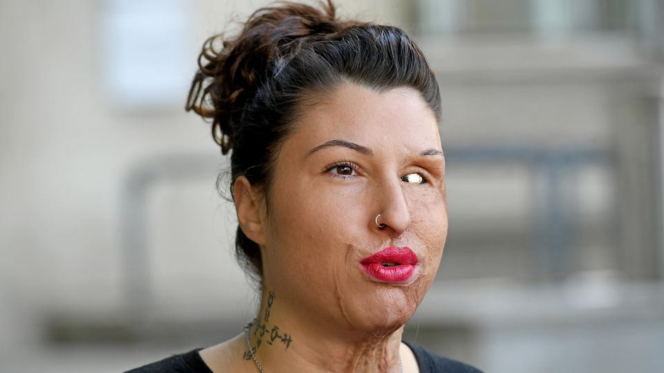 Vanessa Münstermann wird ihr Leben lang an den Folgen des Attentats leiden Vanessa Münstermann wird ihr Leben lang an den Folgen des Attentats leiden