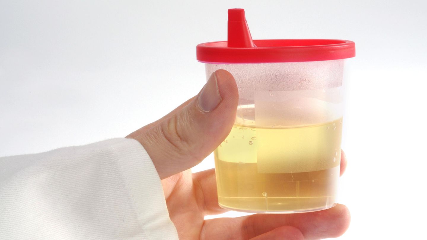 Ein Becher Urin. In Südafrika haben Studenten aus Pipi Ziegelsteine hergestellt