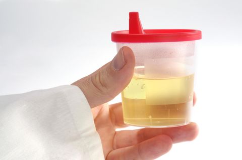 Ein Becher Urin. In Südafrika haben Studenten aus Pipi Ziegelsteine hergestellt