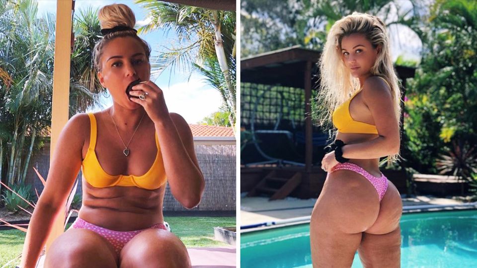 Fast eine Million Follower: Cellulitis am Hintern – warum dieses Model bewusst auf Photoshop verzichtet