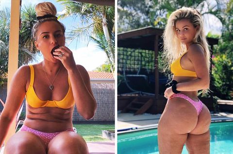 Fast eine Million Follower: Cellulitis am Hintern – warum dieses Model bewusst auf Photoshop verzichtet