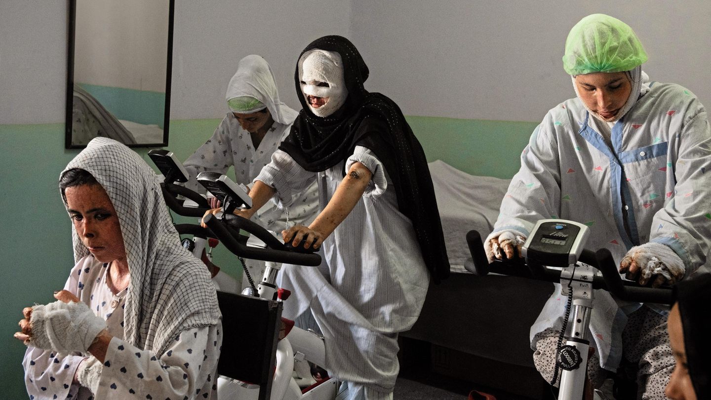 Gewalterfahrungen in Afghanistan: Samira, 17 Jahre, verheiratet Samira (rechts) war ein intelligentes, sprachbegabtes Mädchen, das man mit elf Jahren zwang, seinen 16-jährigen Cousin zu heiraten. Seither bestand ihr Leben aus Prügeln und Demütigung. Dreimal versuchte sie, mit Rattengift ihr Leben zu beenden. Im Juni übergoss sie sich mit Petroleum und zündete sich an. Ein paar Tage nachdem dieses Foto in einem Krankenhaus in Kabul entstanden war, verließ Samira das Hospital gegen den Willen der Ärzte und erlag kurz danach ihren schweren Verbrennungen. Samira, 17 Jahre, verheiratet Samira (rechts) war ein intelligentes, sprachbegabtes Mädchen, das man mit elf Jahren zwang, seinen 16-jährigen Cousin zu heiraten. Seither bestand ihr Leben aus Prügeln und Demütigung. Dreimal versuchte sie, mit Rattengift ihr Leben zu beenden. Im Juni übergoss sie sich mit Petroleum und zündete sich an. Ein paar Tage nachdem dieses Foto in einem Krankenhaus in Kabul entstanden war, verließ Samira das Hospital gegen den Willen der Ärzte und erlag kurz danach ihren schweren Verbrennungen.