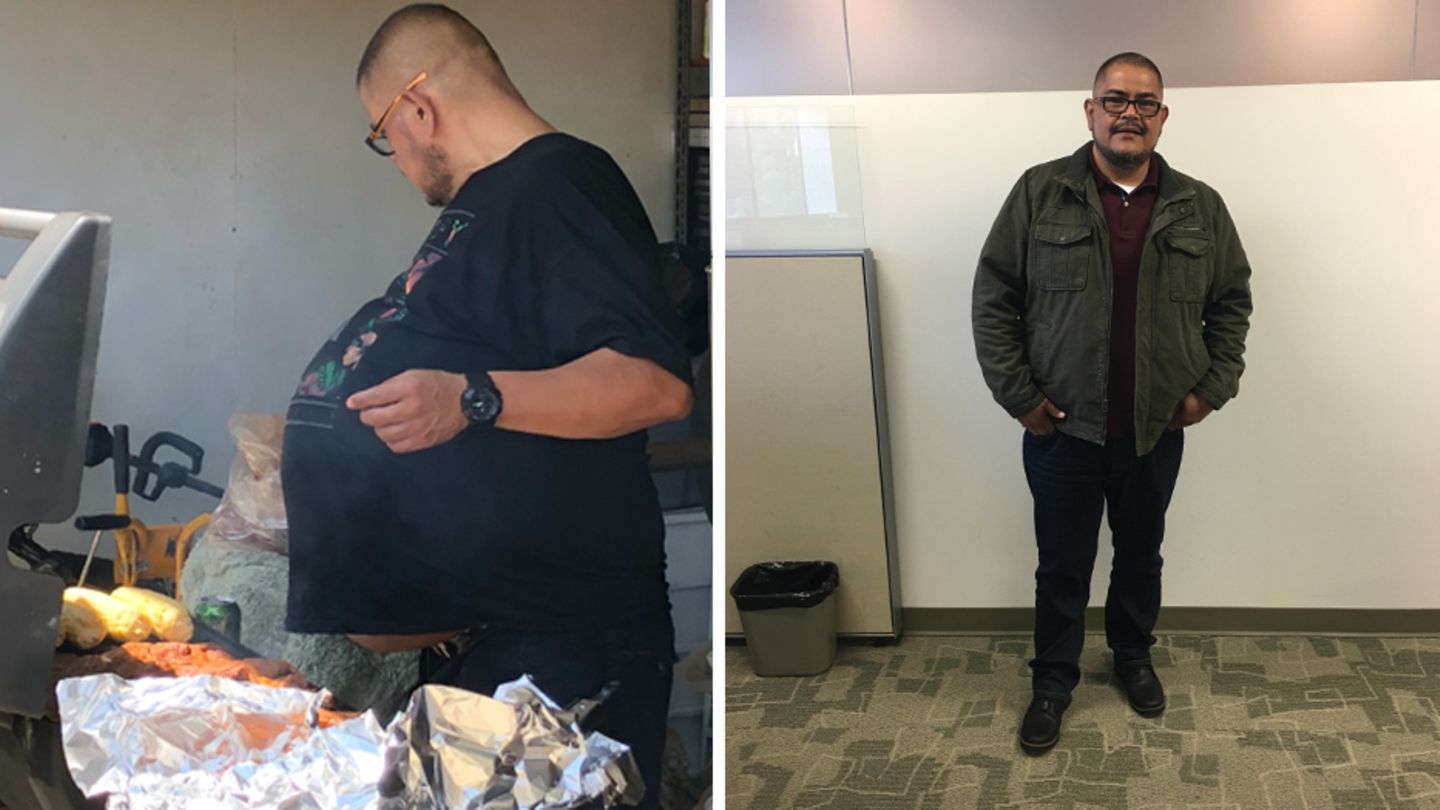 Hector Hernandez vor dem Eingriff im Sommer 2018 (links) - und danach