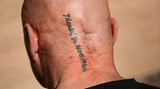 Die Narbe am Schädel und das Tattoo, mit dem Geulen seinem Chirurgen dankt – "Thanx Dr. Martin Theis"