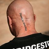 Die Narbe am Schädel und das Tattoo, mit dem Geulen seinem Chirurgen dankt – "Thanx Dr. Martin Theis"