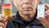 nachrichten deutschland - urinprobe