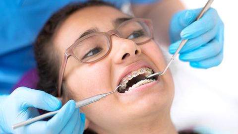 Zahnspangen: Ein junges Mädchen während einer Behandlung beim Kieferorthopäden