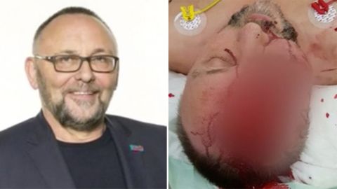 Frank Magnitz: Bremer AfD-Chef wird von Unbekannten angegriffen und schwer verletzt