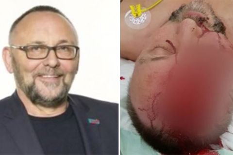 Frank Magnitz: Bremer AfD-Chef wird von Unbekannten angegriffen und schwer verletzt