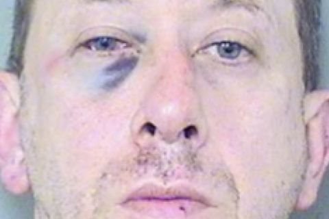 Ein blasser Mann mit blau geschlagenem rechten Augen schaut auf einem Polizeibild gerade in die Kamera