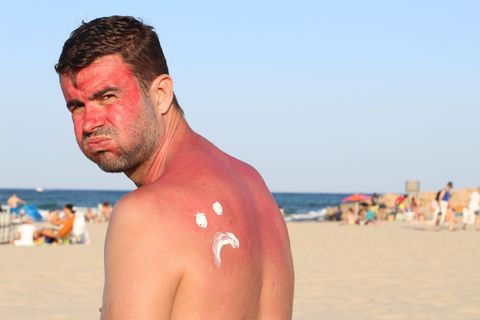 Dieser Kollege hätte "Slip! Slop! Slap!" einmal ernst nehmen müssen