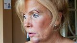 Spitz' Mutter hat Blessuren im Gesicht an Kinn und Augenbraue