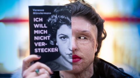 Vanessa Münstermann Säure Opfer Attentat