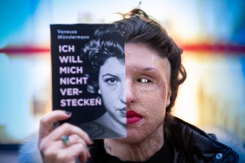 Vanessa Münstermann Säure Opfer Attentat